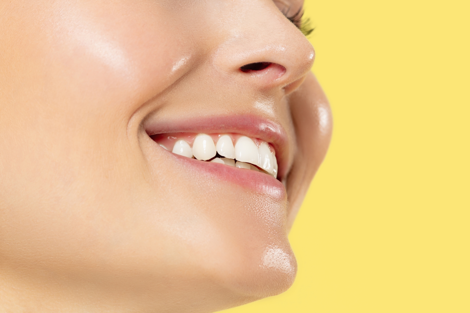 dientes-blancos-12