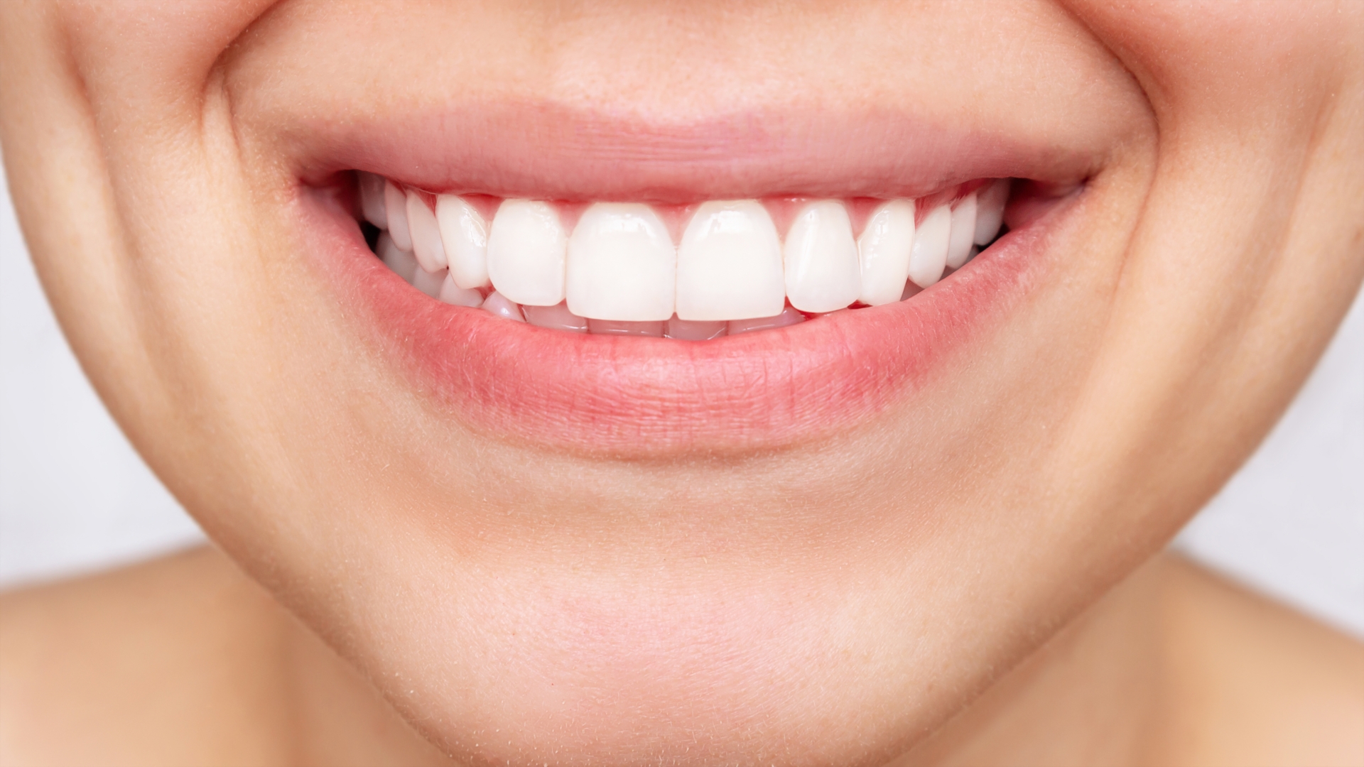 dientes-blancos-13