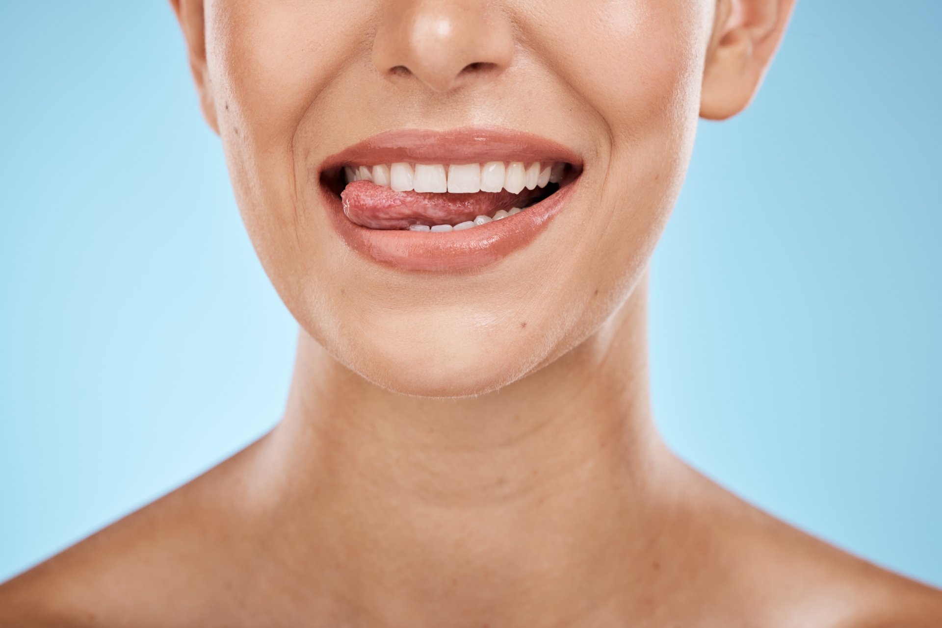 dientes-blancos-15