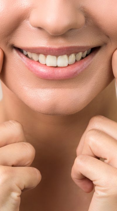 dientes-blancos-10